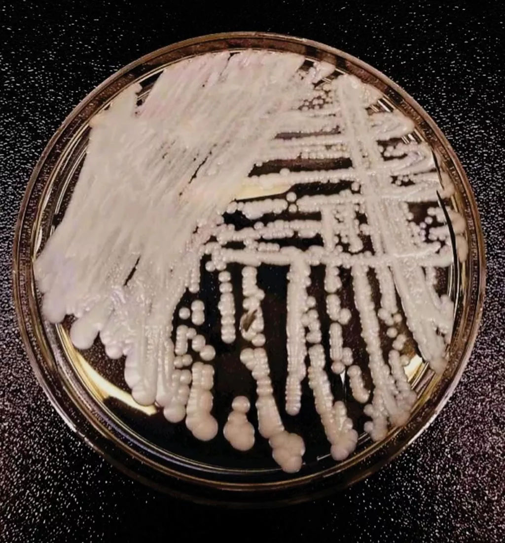 耳念珠菌 超级真菌在美国爆发60 致死 疾病预防 水葫芦健康网