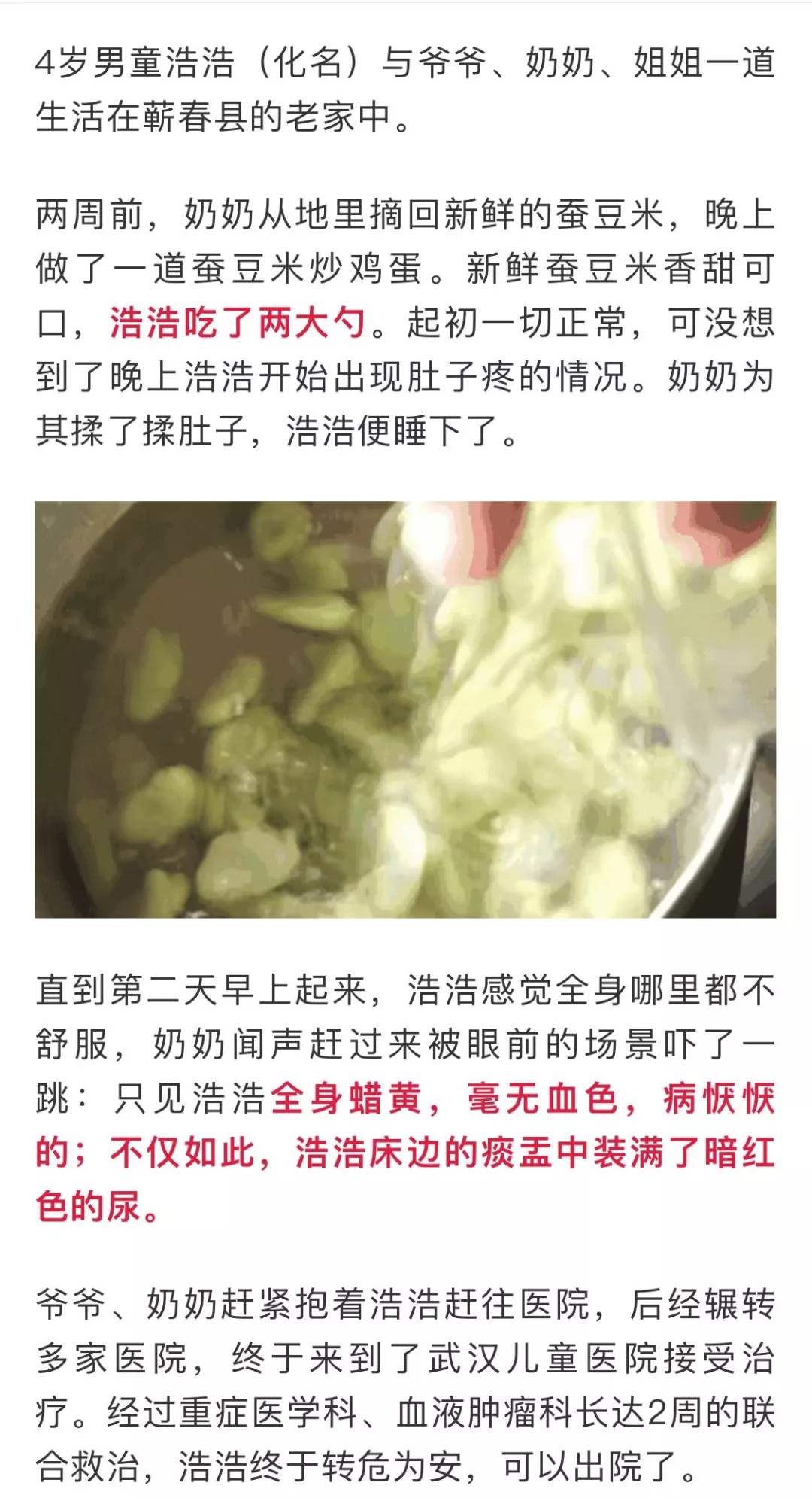 蚕豆病是什么 蚕豆病可以吃蚕豆吗 母婴养护 水葫芦健康网