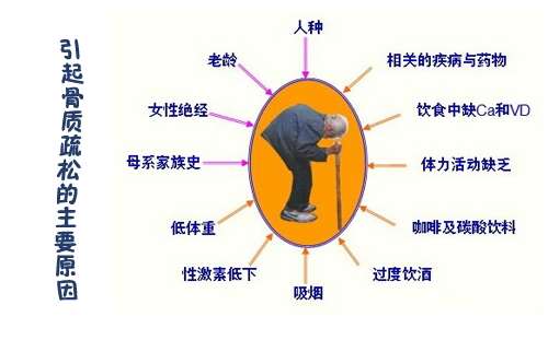 女性骨质疏松 常吃这6种食物能预防 女性保健 水葫芦健康网